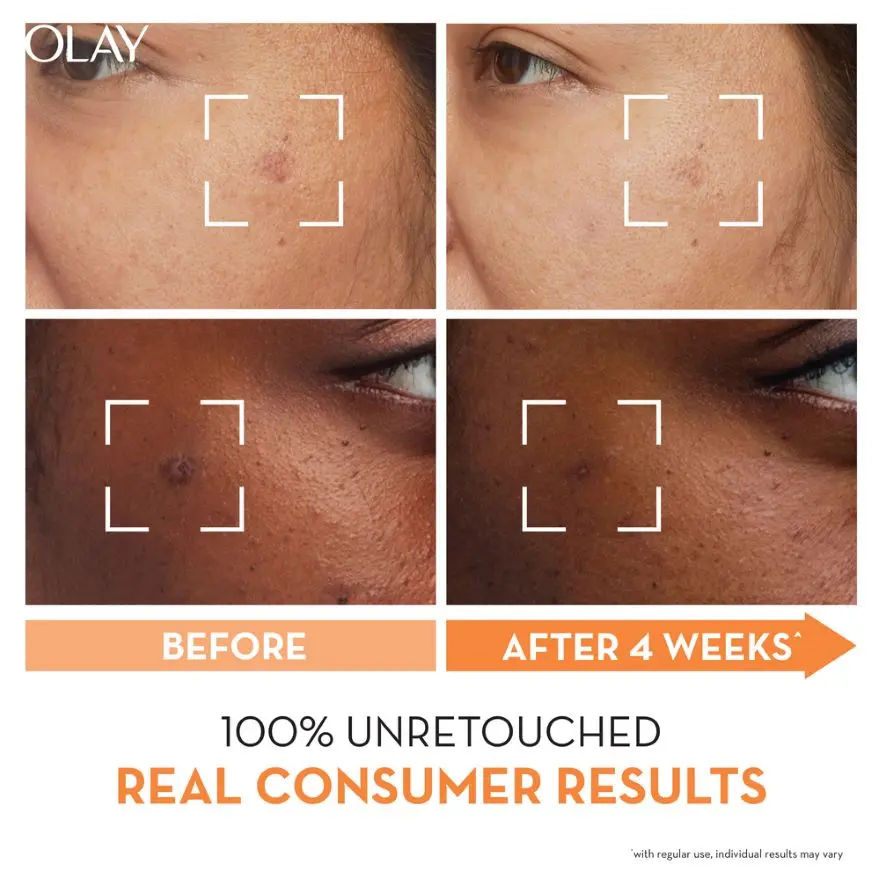 Olay Niacinamide + Vitamin C Super Serum reduce dark spots