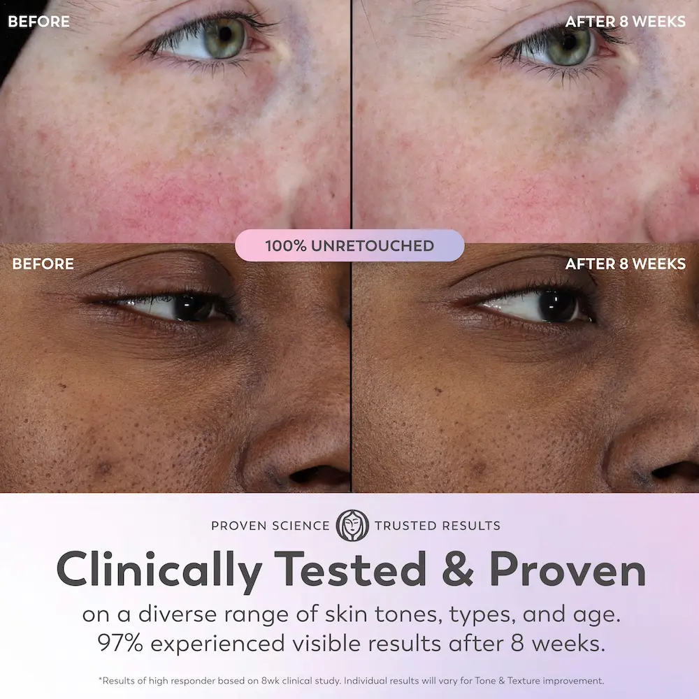 Olay Super Serum before and after